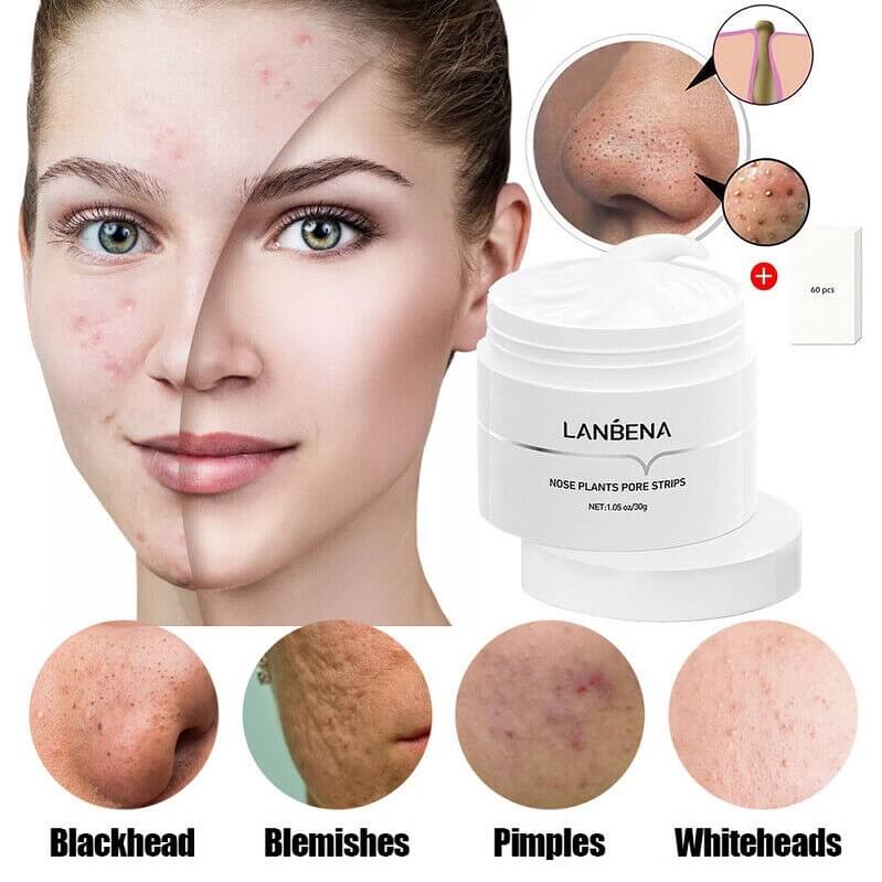 LANBENA™ face mask against blackheads 